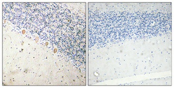 PFKM antibody