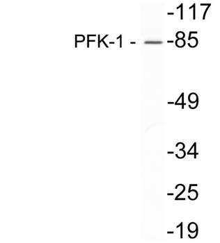 PFKM antibody