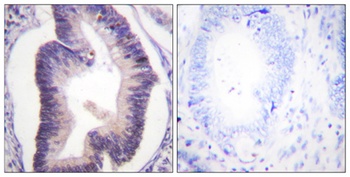 PFK-2 car antibody