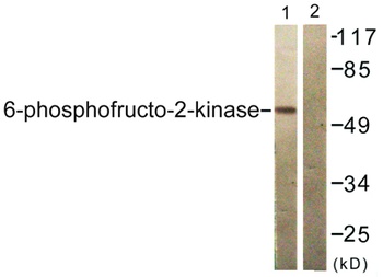 PFK-2 car antibody