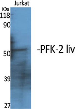 PFK-2 liv rabbit pAb