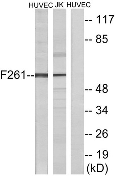 PFK-2 liv rabbit pAb