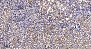 PFK-2 liv antibody