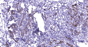 PFK-2 liv/tes antibody