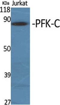 PFK-C rabbit pAb Antibody