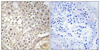 PFK-C rabbit pAb Antibody