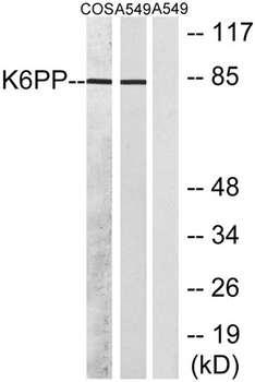 PFK-C rabbit pAb Antibody