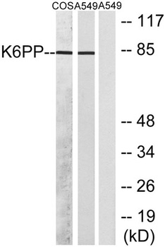 PFK-C antibody