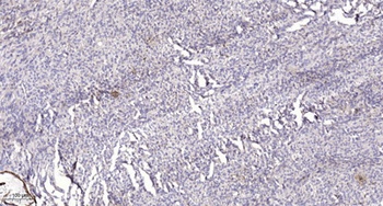 PGE synthase rabbit pAb