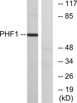 PHF1 rabbit pAb