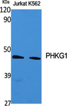 PHKG1 rabbit pAb