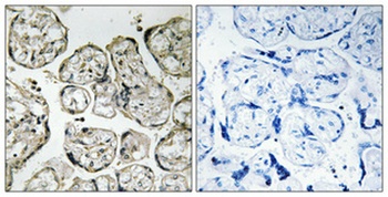 PI 3-kinase p85α rabbit pAb