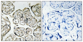 PI 3-kinase p85 alpha antibody