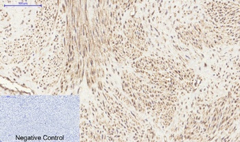 PI 3-kinase p85 alpha/gamma antibody