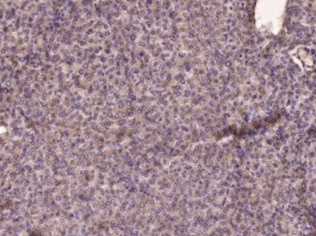 PI 3-kinase p85 beta antibody