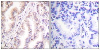 PIAS 1 antibody