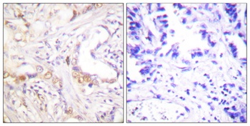 PIAS 3 antibody