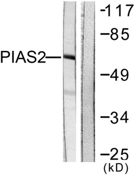 PIASx rabbit pAb