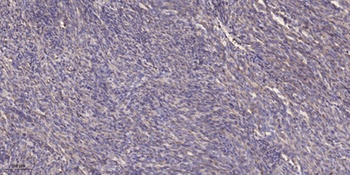 PIG3 antibody