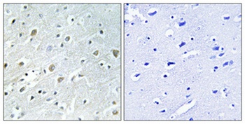 PIG-X antibody