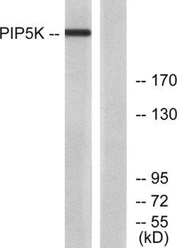 PIP5KIII antibody