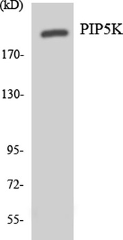 PIP5KIII antibody