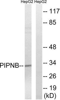 PITPβ rabbit pAb
