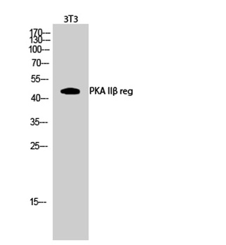 PKA II beta reg antibody