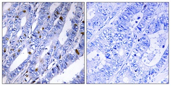 PKA II beta reg antibody