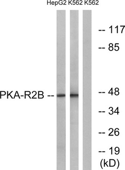 PKA II beta reg antibody