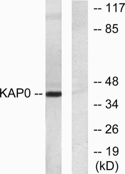 PKA I alpha reg antibody