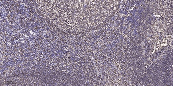 PKA I alpha reg antibody