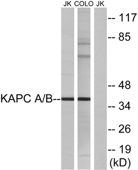 PKA alpha/beta cat antibody