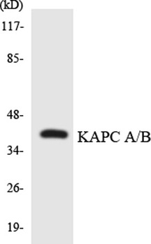 PKA alpha/beta cat antibody