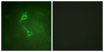 PKC zeta antibody