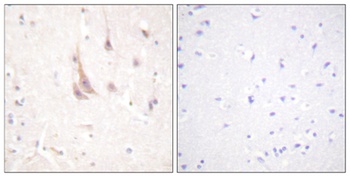 PKC zeta antibody