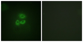 PKD1 rabbit pAb