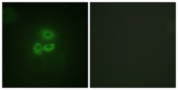 PKD1 antibody