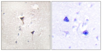 PKD1 rabbit pAb