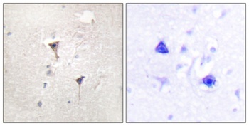 PKD1 antibody