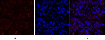 PKM2 antibody