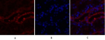 PKM2 antibody