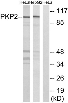 Plakophilin 2 rabbit pAb
