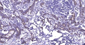Plakophilin 2 rabbit pAb