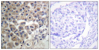 PLC β3 rabbit pAb