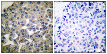 PLC γ1 rabbit pAb Antibody