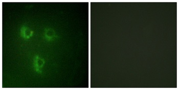 PMEPA1 antibody