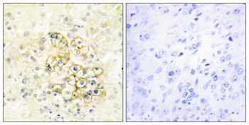 PMEPA1 rabbit pAb