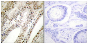 PML antibody