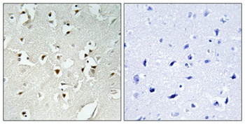 PMS1 antibody